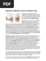 Download Sinusitis Maksilaris Karena Infeksi Gigi by Rice Nurhayati SN94258178 doc pdf
