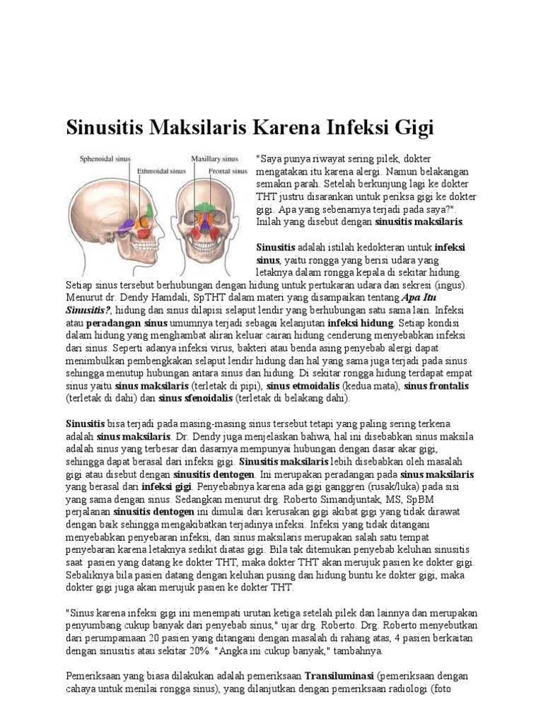 Mild Bilateral Maxillary Sinusitis Answers From Doctors