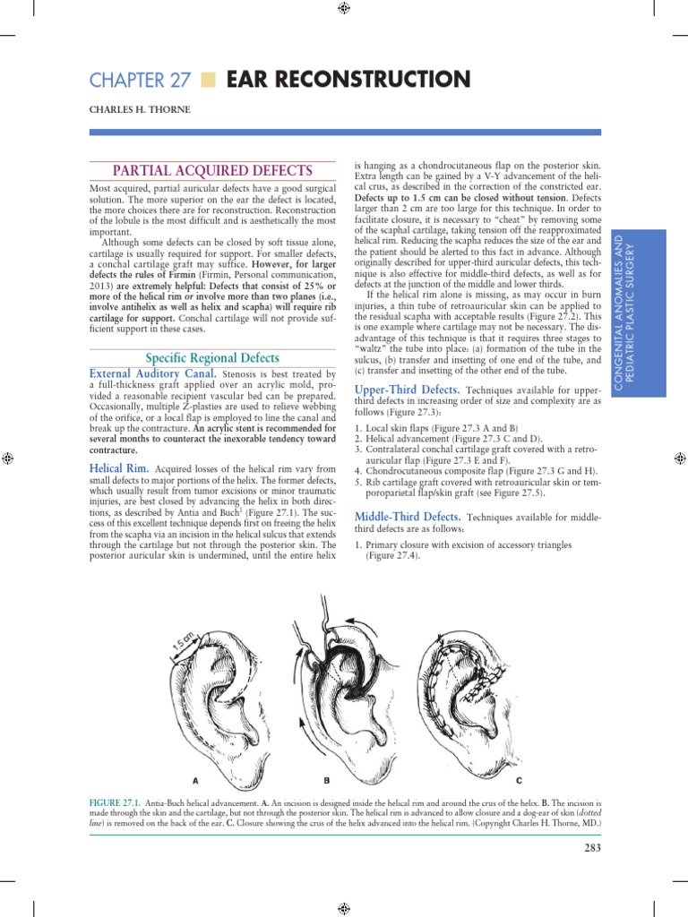 Pediatric Ear Reconstruction Techniques | PDF | Ear | Surgical Specialties
