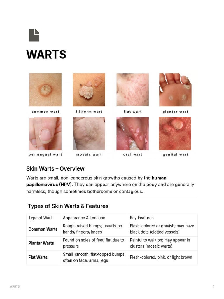 WARTS | PDF | Anesthesia | Clinical Medicine
