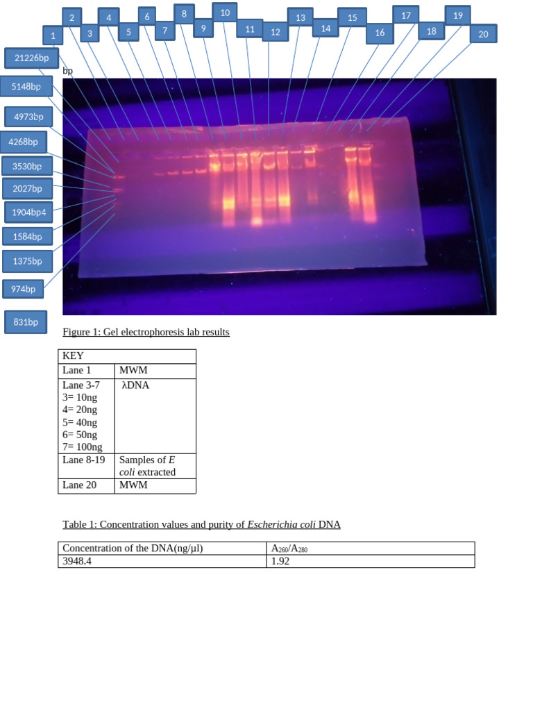 Gel Electrophoresis Lab Results | PDF