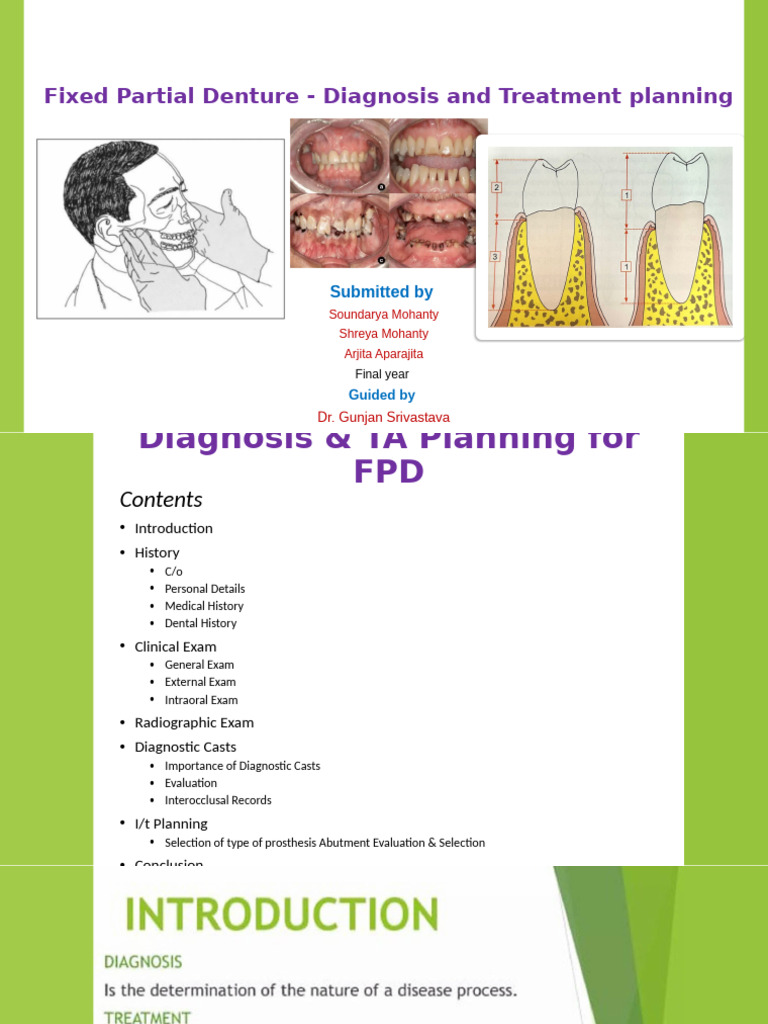 FPD Diagnosis and Treatment Planning Guide | PDF | Dental Anatomy ...