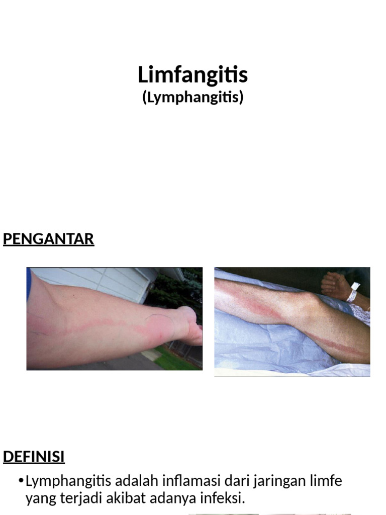 LYMPHANGITIS and Lymphoedema | PDF