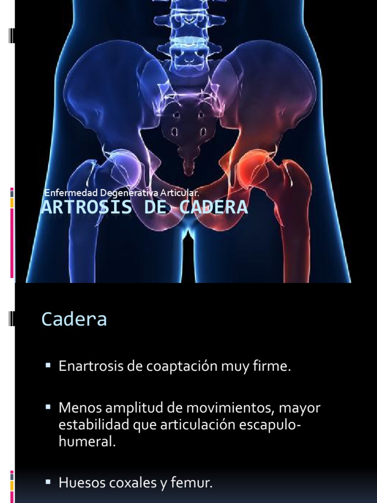 artrosis-de-cadera-diagn-stico-y-tratamiento-pdf-osteoartritis