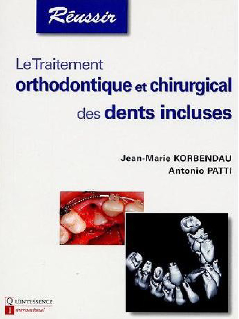Traitement des dents incluses en orthodontie PDF Dent humaine Dent — free download