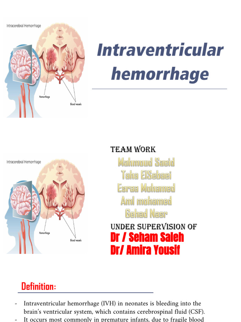 Intraventricular Hemorrhage in Neonates | PDF | Nervous System | Physiology