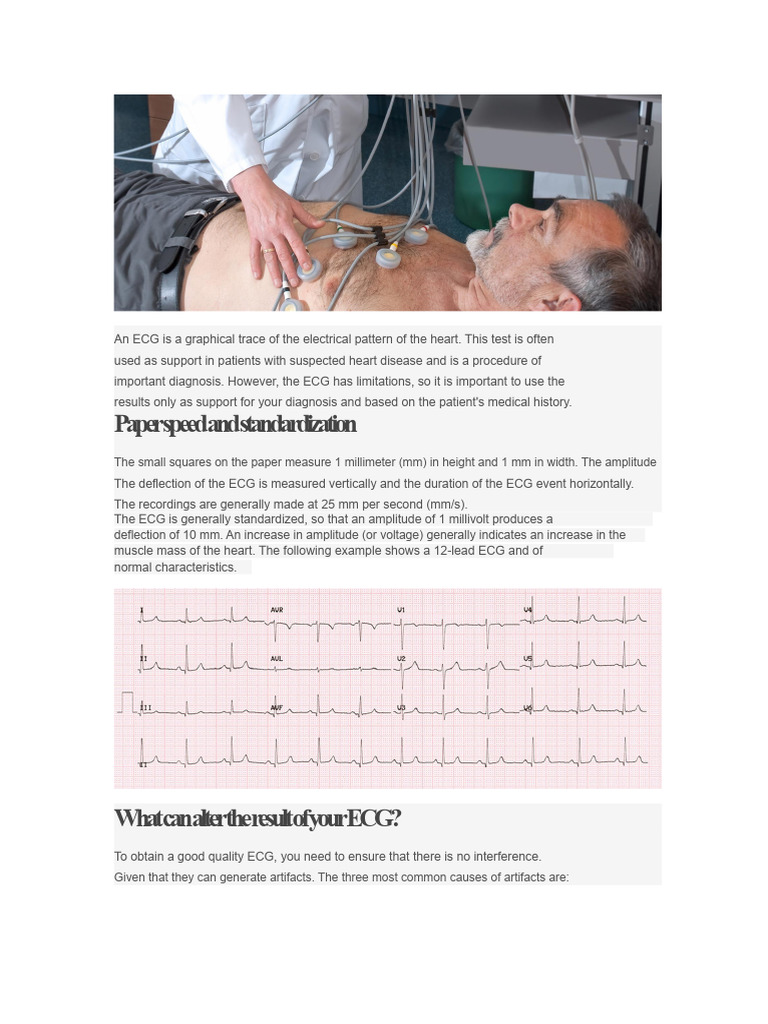 Understanding ECG: Procedure and Interpretation | PDF ...
