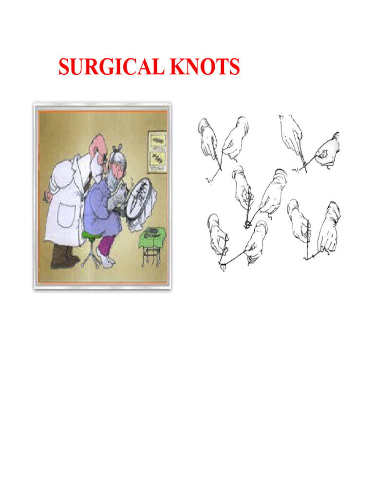 NODES .ppt | PDF | Surgical Suture | Knot