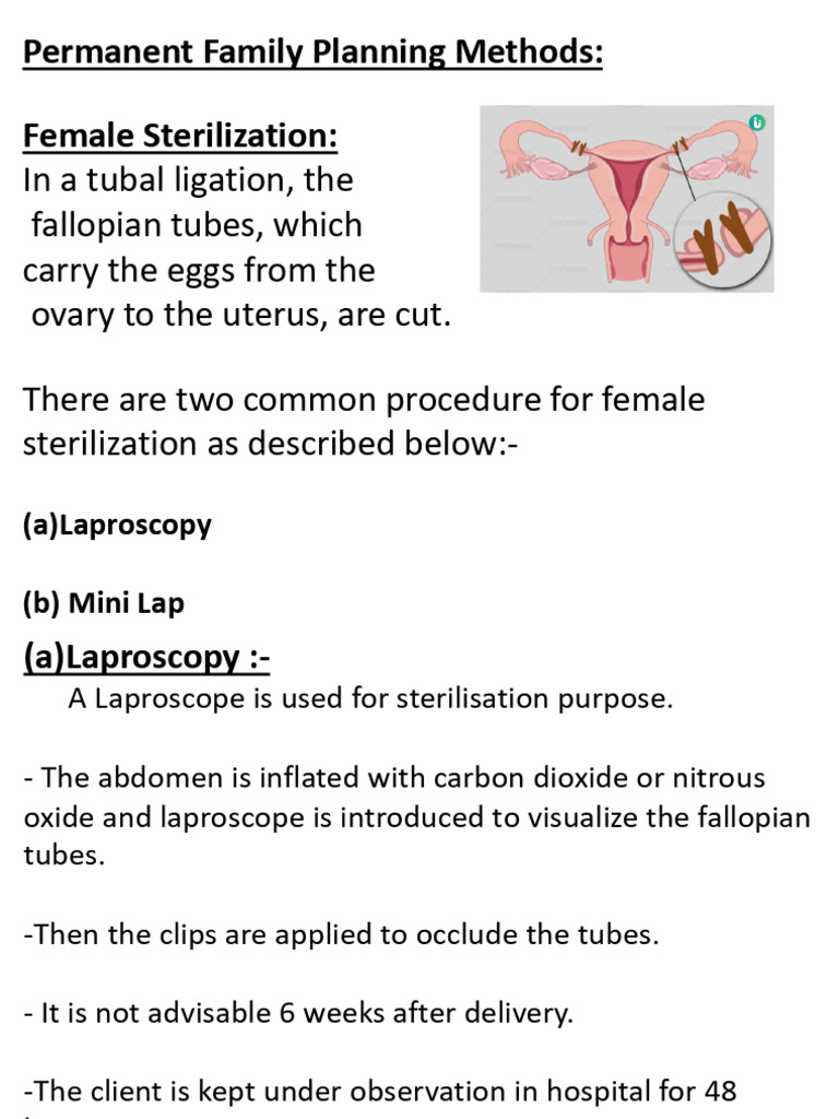 Permanent Family Planning Methods Explained | PDF | Sexual Anatomy ...