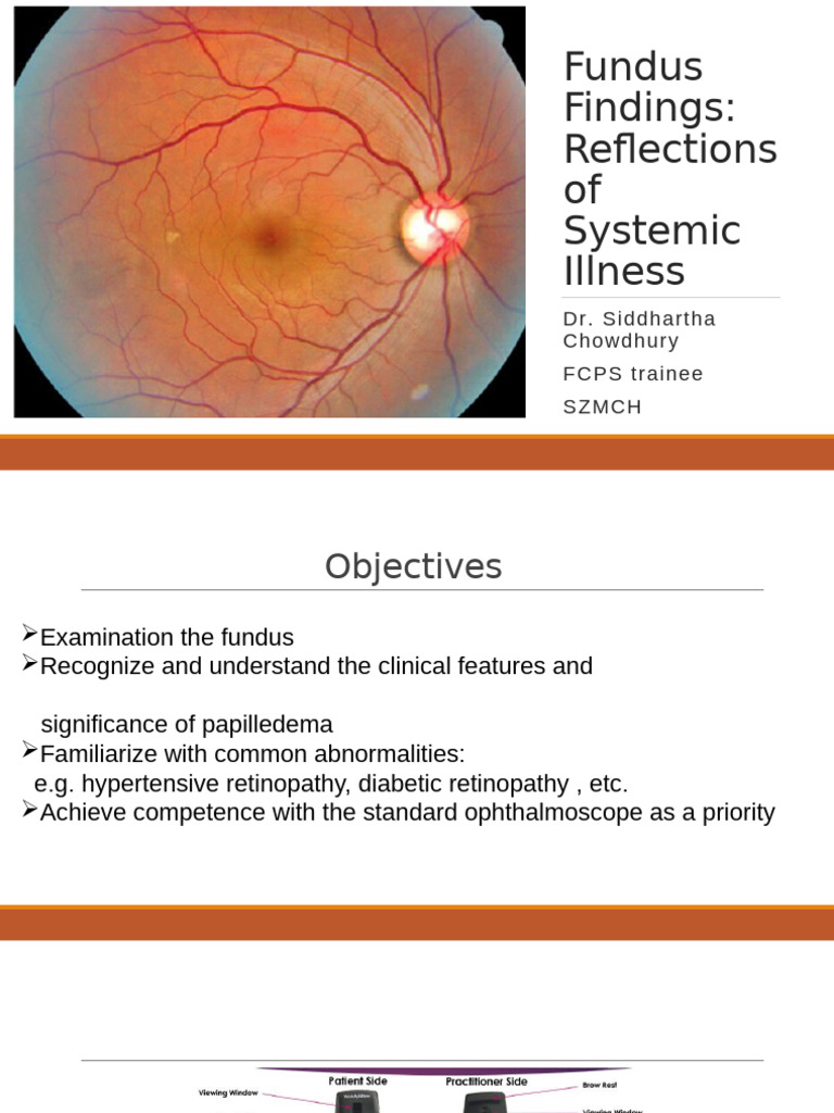 Fundus Findings Reflections of Systemic Illness by DR. Siddhartha ...
