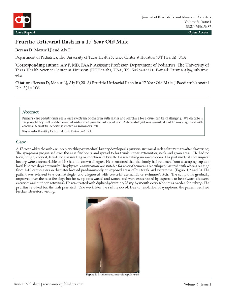 3106 Pruritic Urticarial Rash in A 17 Year Old Male | PDF | Clinical ...