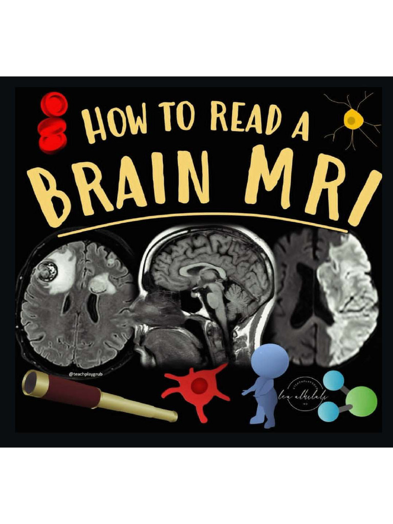 How To Read A Brain MRI | PDF