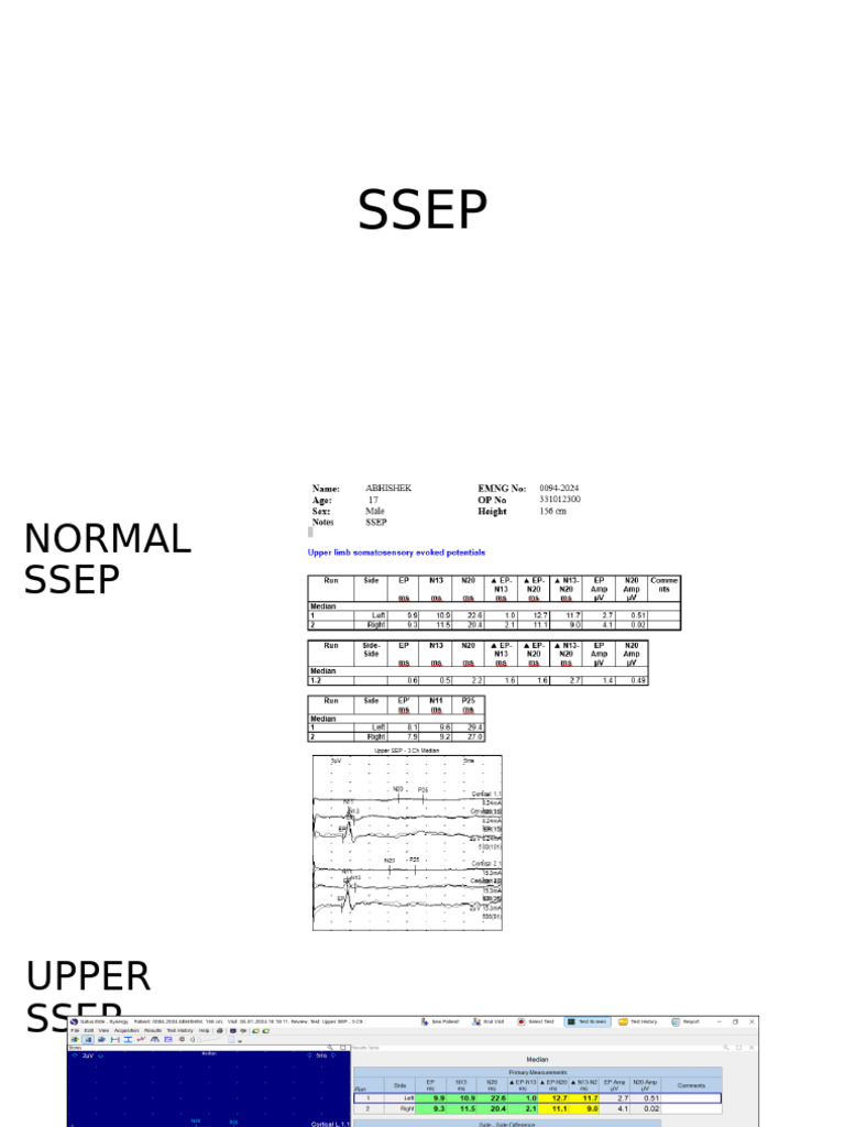 SSEP | PDF