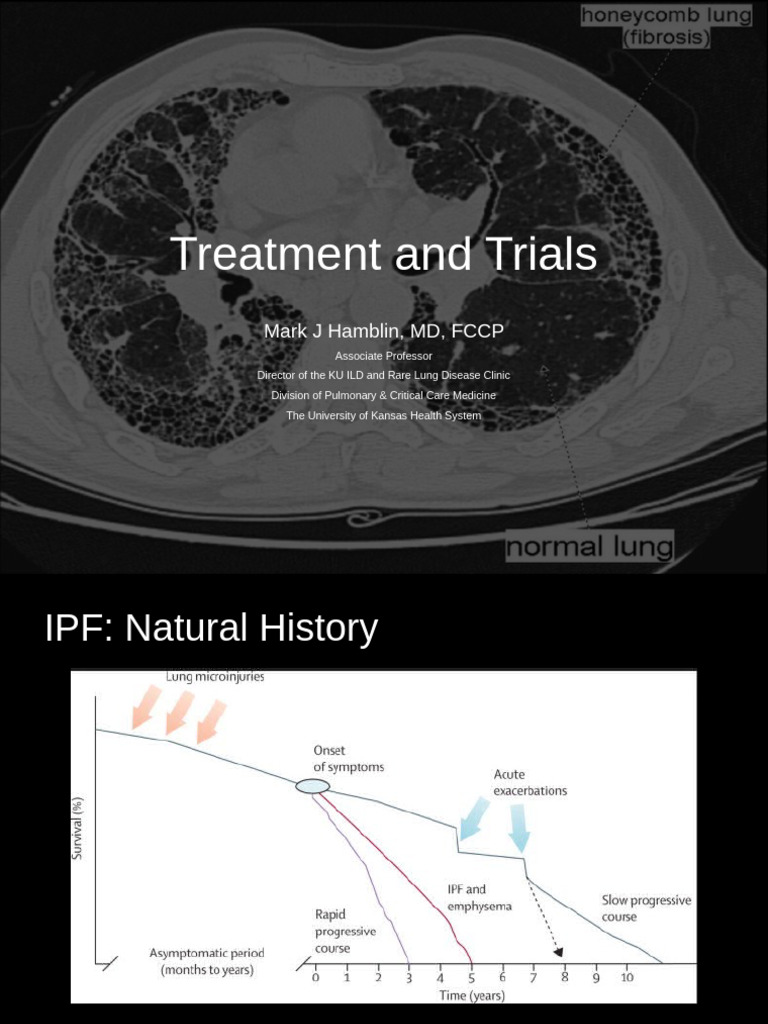 IPF Treatments and Clinical Trials Overview | PDF | Phases Of Clinical ...