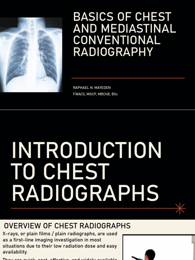 Chest and Mediastinal Radiography | PDF | Radiography | Medical Physics