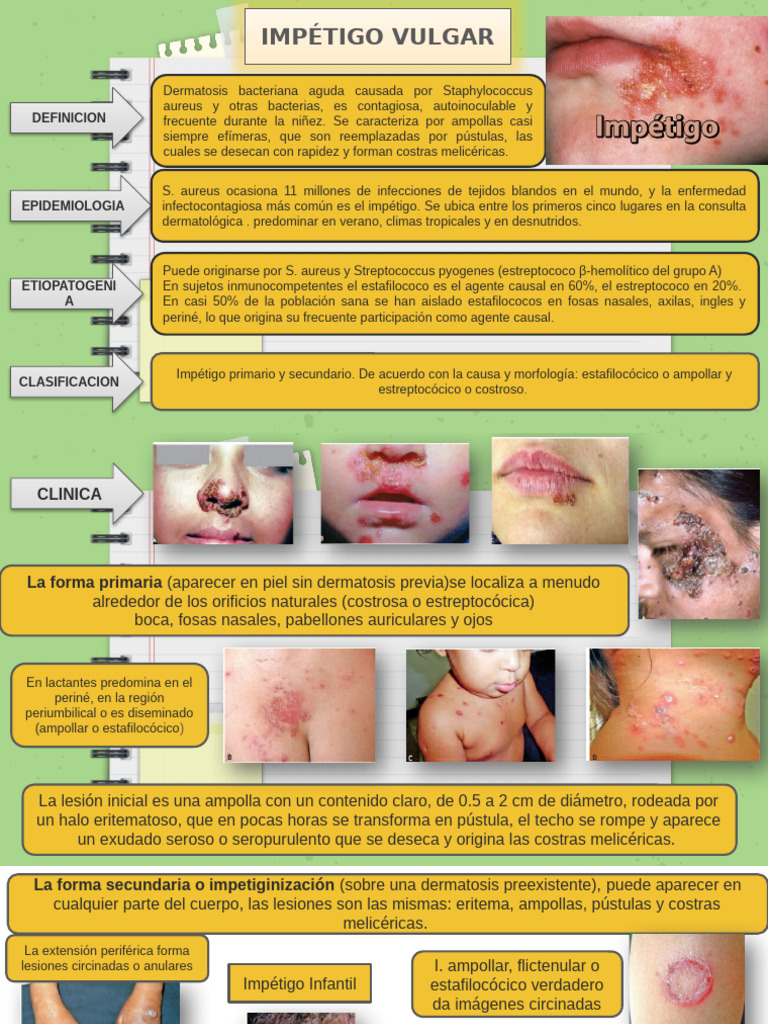 Impétigo: Causas, Síntomas y Tratamiento | PDF | Microbiología ...