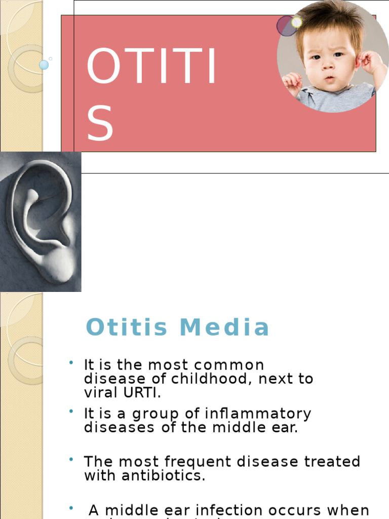 Ilide - Info Understanding Otitis Media A Comprehensive Review of The ...
