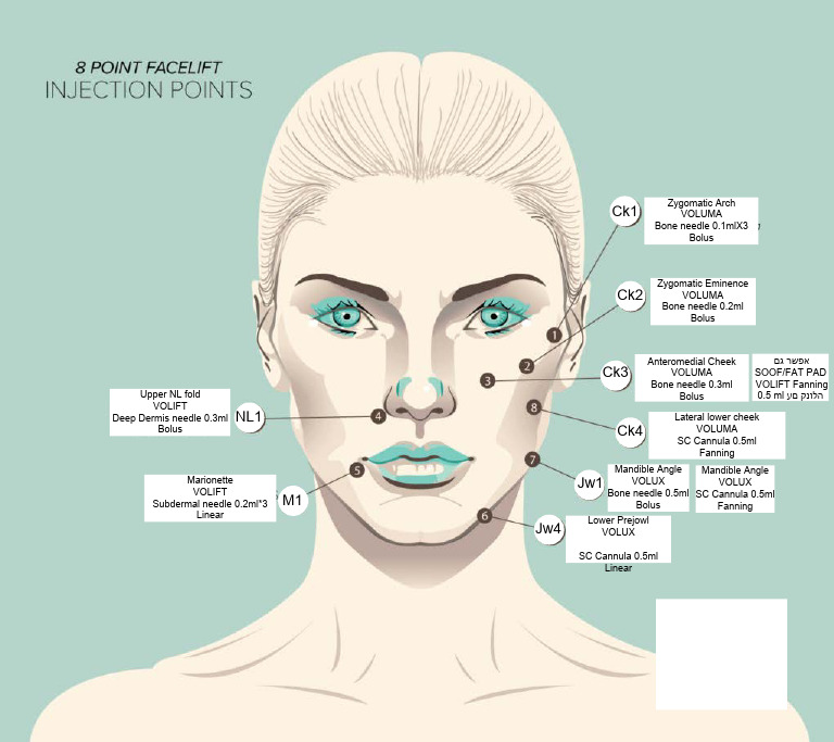 8 Point Facelift Injection תרשים שלי | PDF