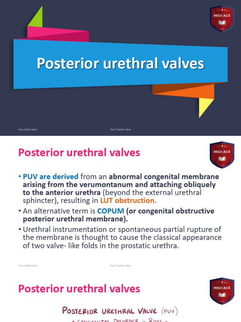 Posterior Urethral Valves and Hypospadias | PDF | Urology ...