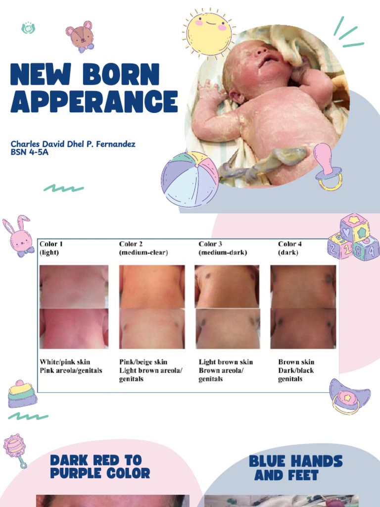 Newborn Appearance and Conditions Guide | PDF