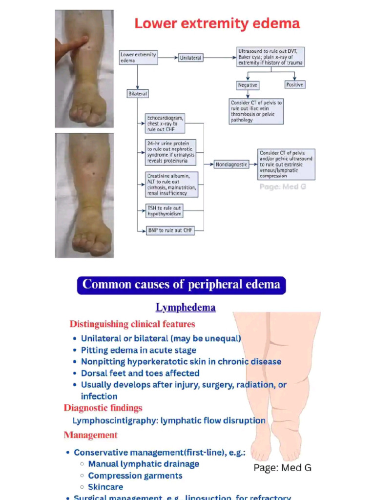 Edema | PDF