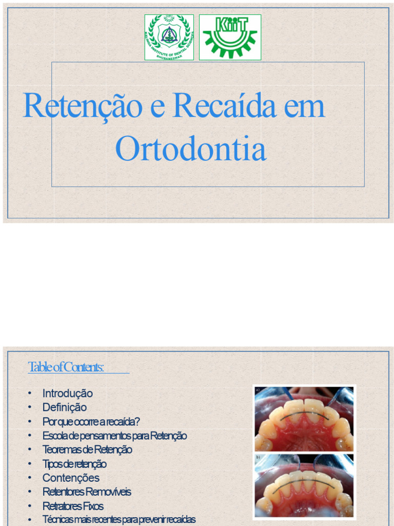 Retenção e Recaída em Ortodontia: Guia Completo | PDF | Ortodontia ...
