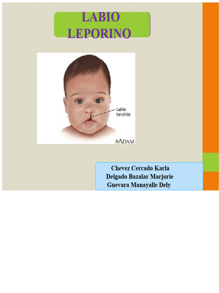 Definisi dan Penyebab Labio Leporino | PDF