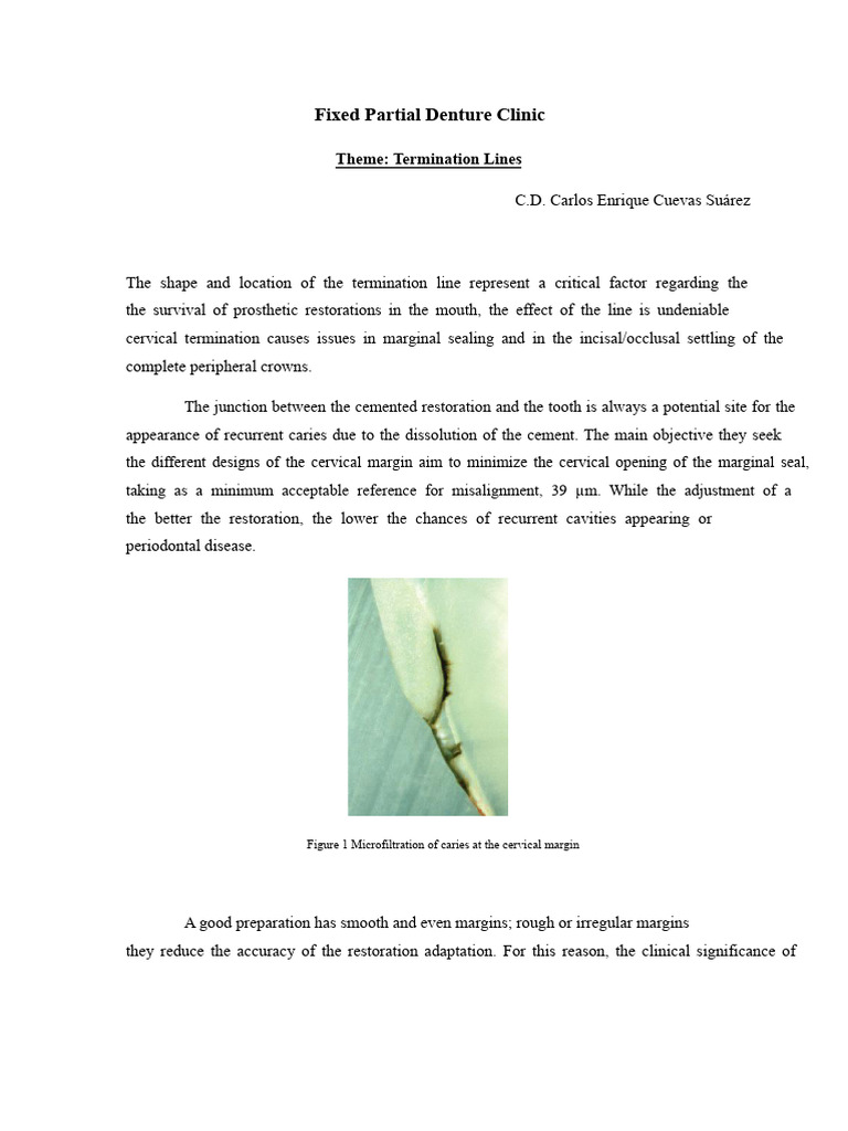 Termination lines - Fixed Partial Denture Clinic | PDF | Tooth | Dental ...