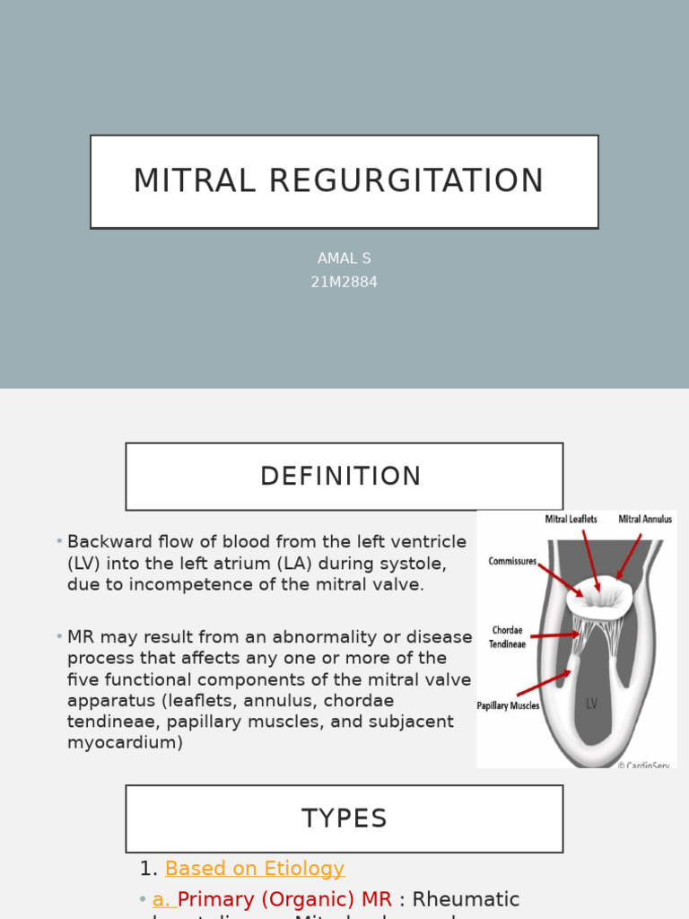 Understanding Mitral Regurgitation | PDF