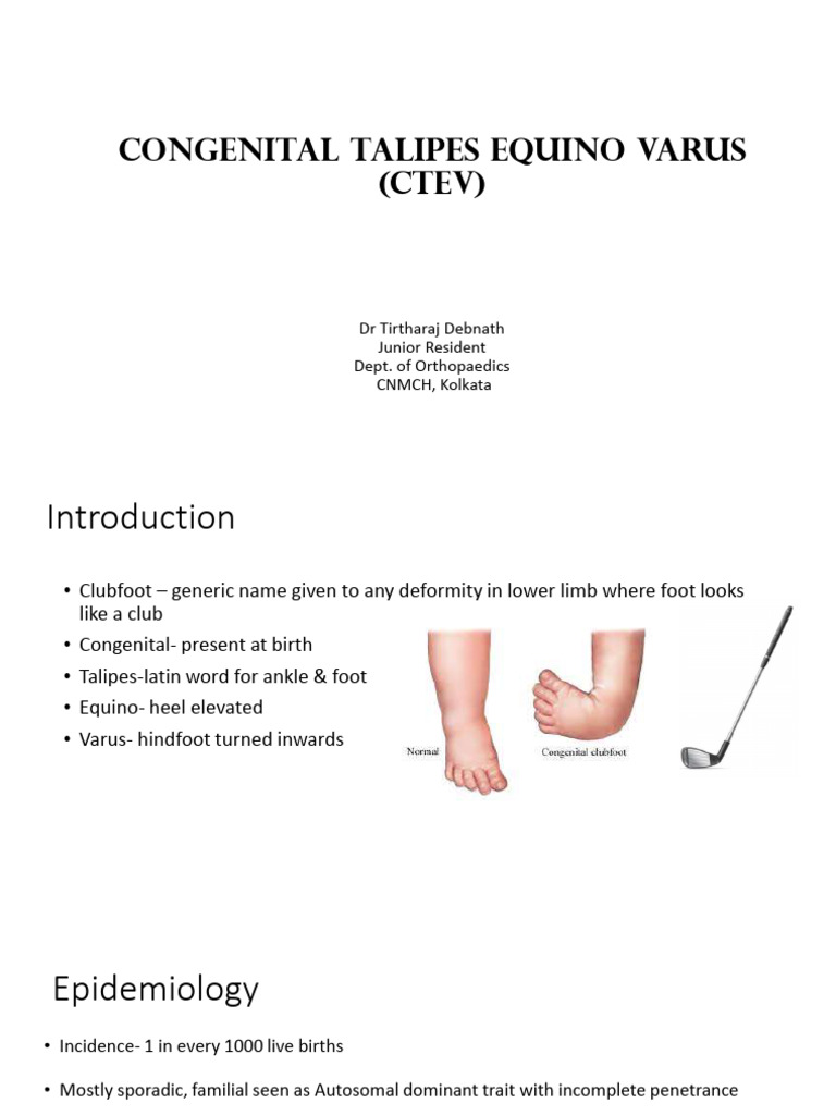 Congenital Talipes Equino Varus Overview | PDF | Foot | Ankle