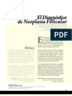 Neoplasia Folicular