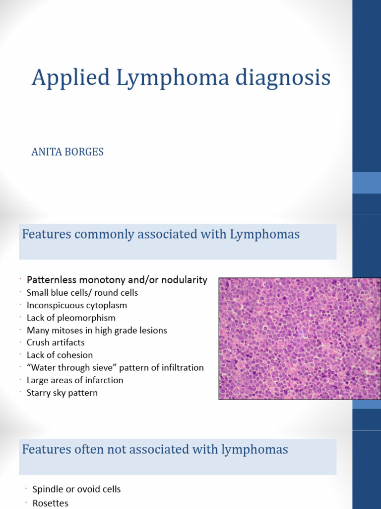 Lymphoma Diagnosis and Evaluation Guide | PDF | Lymphoma | Lymph Node