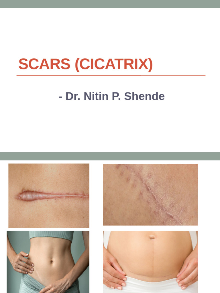Understanding Scars: Types and Significance | PDF | Scar | Wound