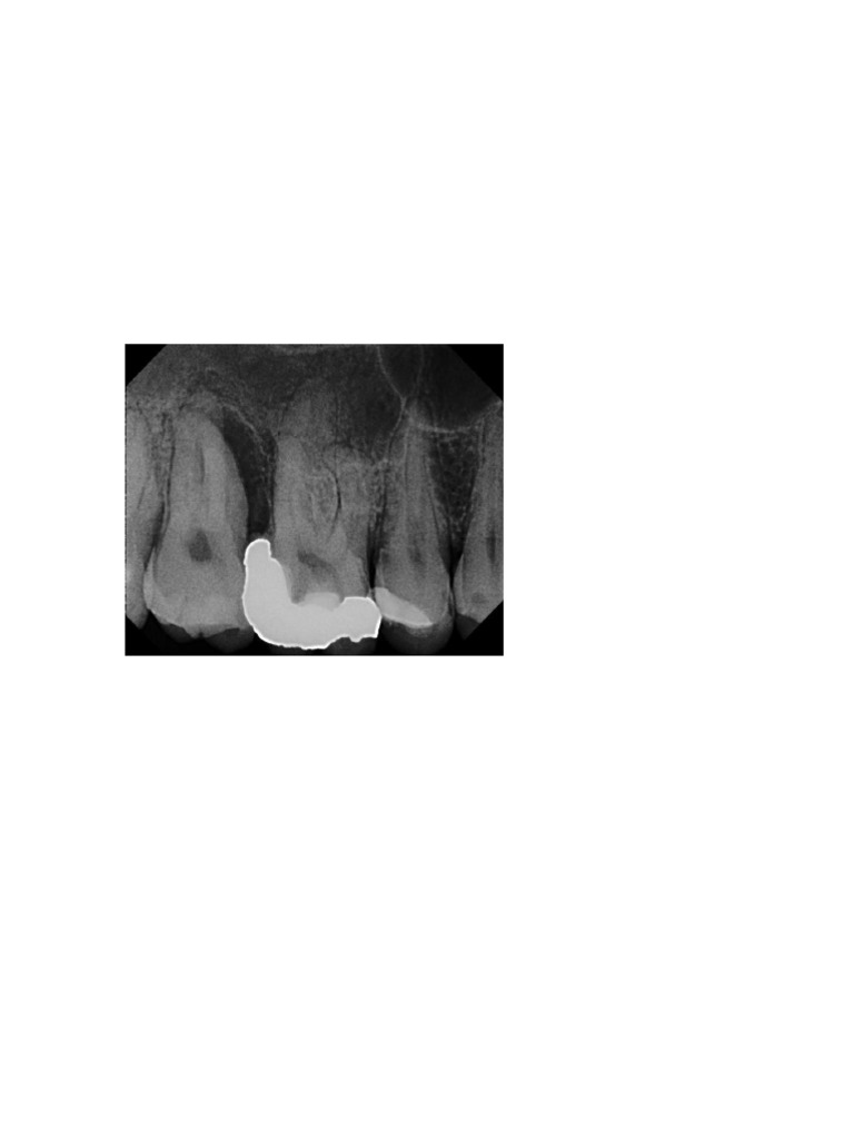 ACJ2 | PDF | Dental Anatomy | Mouth