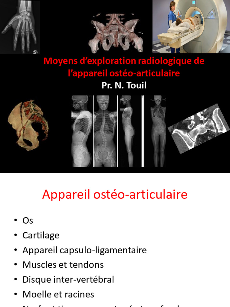 Exploration radiologique de l'ostéo-articulaire | PDF | Échographie ...