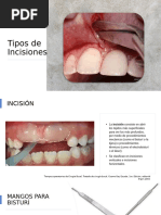 Tipos de Incisiones y Colgajos Dentales | PDF | Cirugía | Boca