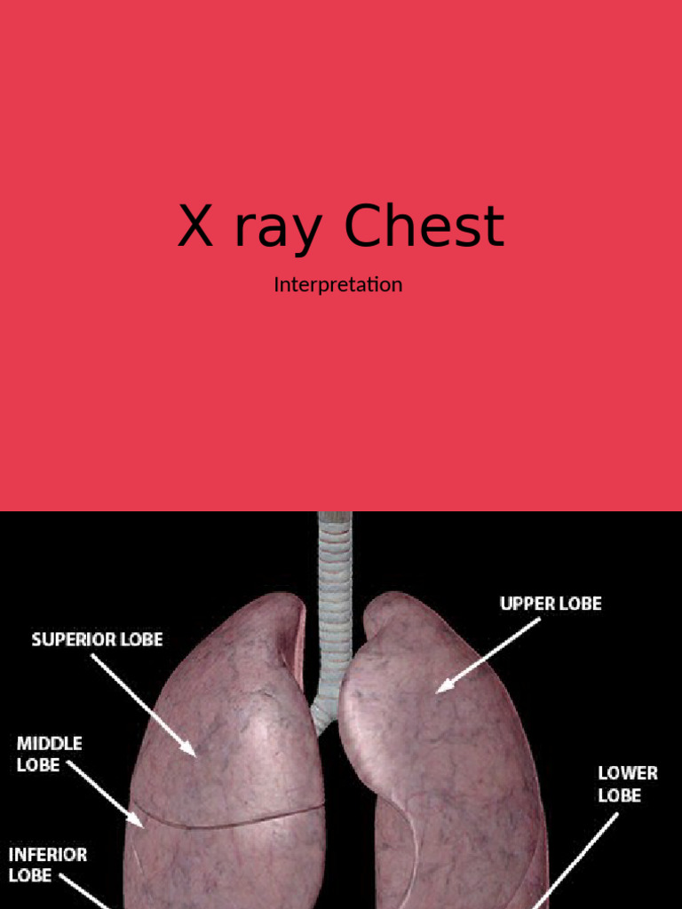 Radiological Anatomy of Chest | PDF | Thorax | Heart