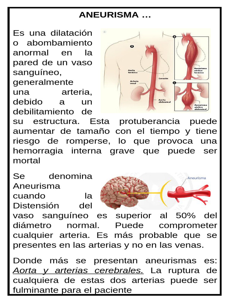 Aneurisma: Tipos, Síntomas y Riesgos | PDF | Aorta | Artería