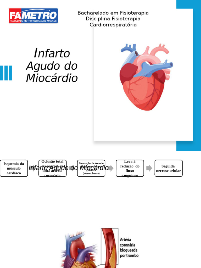 Causas e Sintomas do Infarto Agudo | PDF | Doença arterial coronariana ...