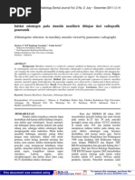 Download Infeksi Odontogen Pada Sinusitis Maxillaris Ditinjau Dari Radiografik Panoramik by Indah Nisita Putri SN94801918 doc pdf