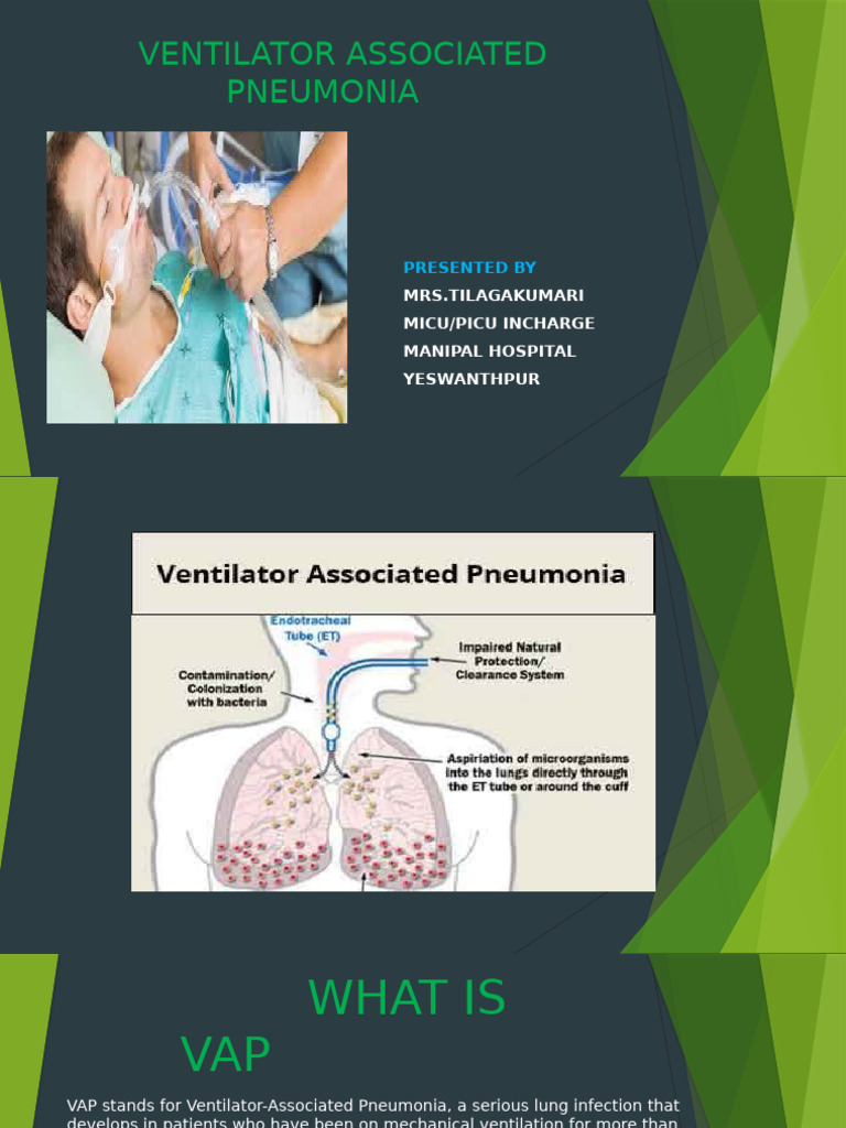 Understanding Ventilator-Associated Pneumonia | PDF