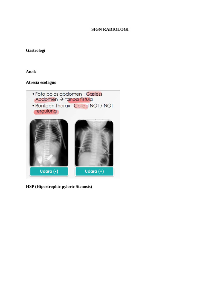 Sign Radiologi | PDF
