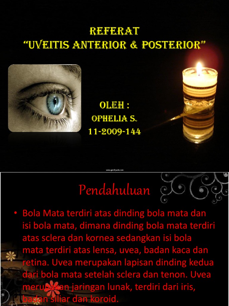 Uveitis Anterior Referat