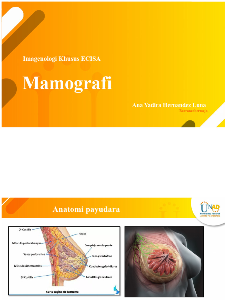 Mamografi YADIRA | PDF