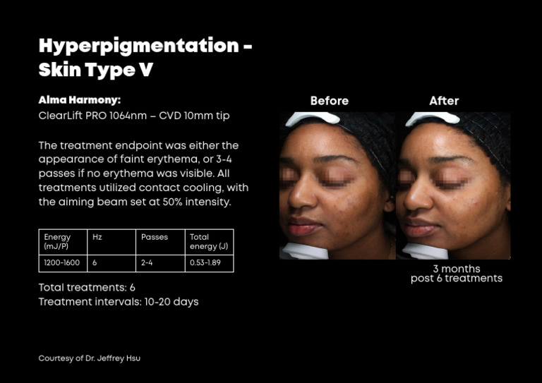 Hyper Pigmentation | PDF