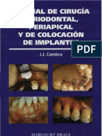 Periodoncia