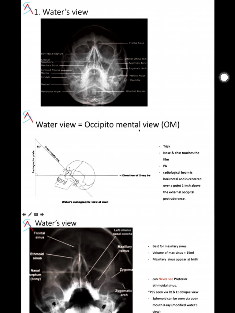 X Rays in Ent | PDF