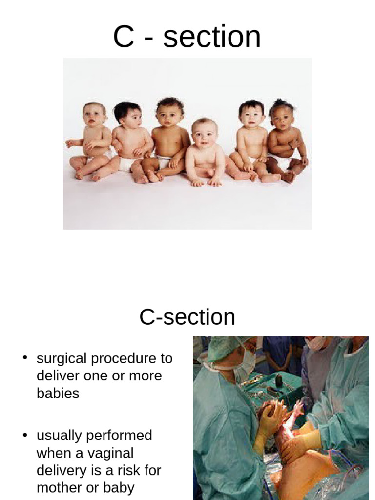 C-Section Overview: Indications & Risks | PDF