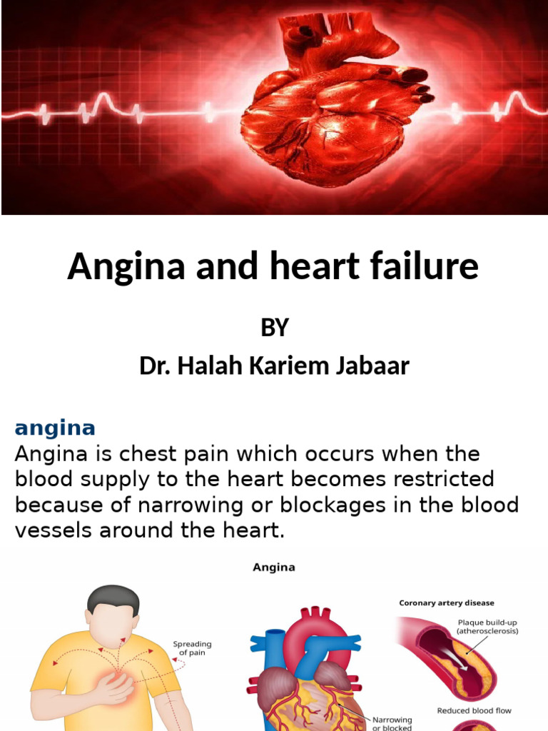 Angina and Heart Failure Overview | PDF | Heart Failure | Heart