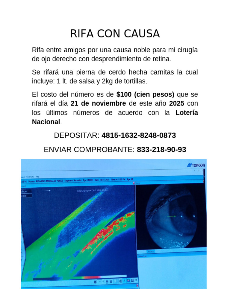 Rifa Con Causa | PDF